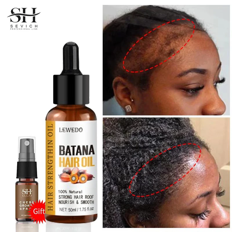 Batana Oil Hair Growth Serum