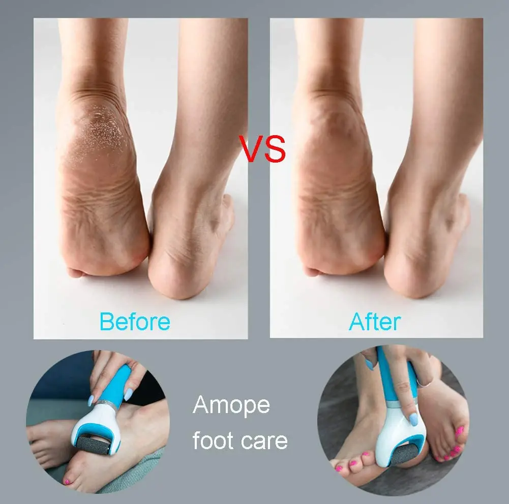 Electric Callus Remover Foot File - Image 6