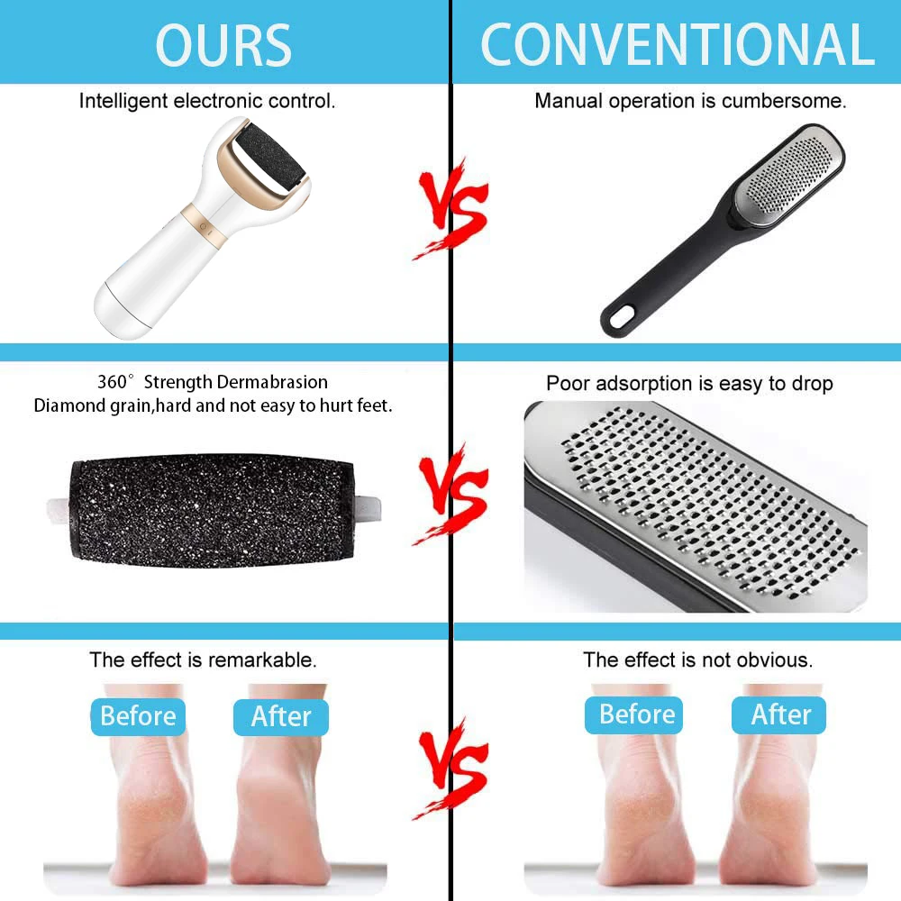 Electric Callus Remover Foot File - Image 5