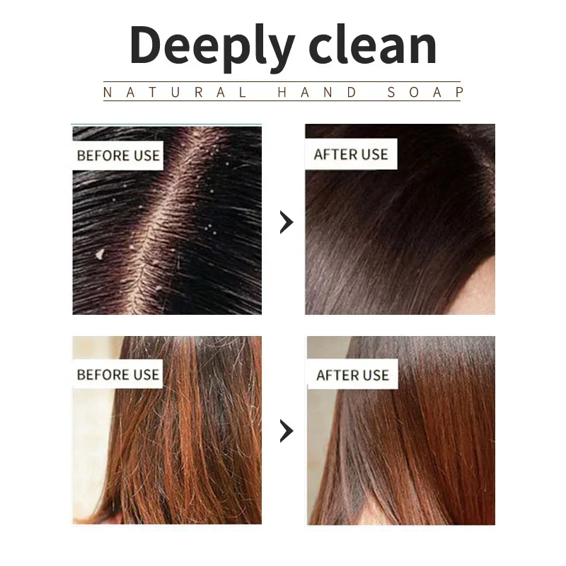Lavender Oil-Control Shampoo - Image 2